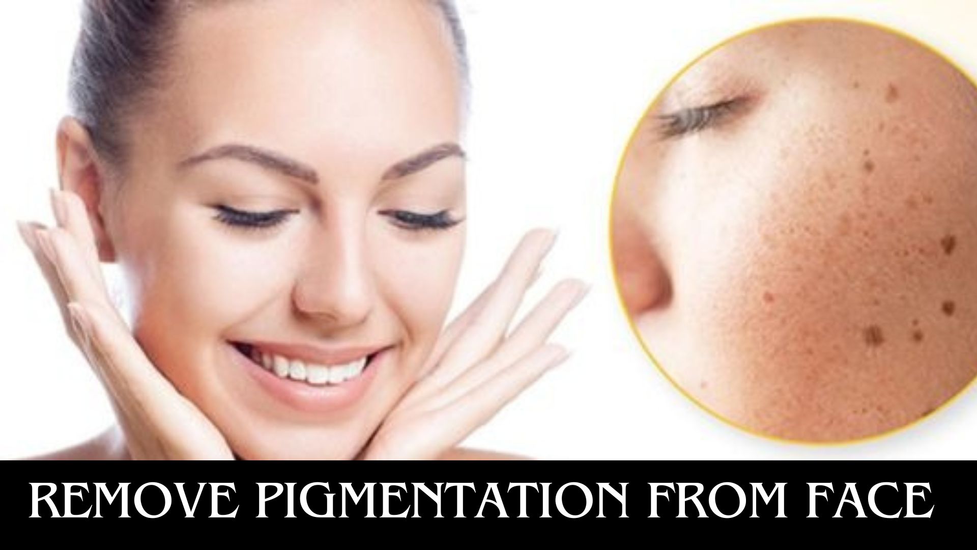 Remove Pigmentation From Face