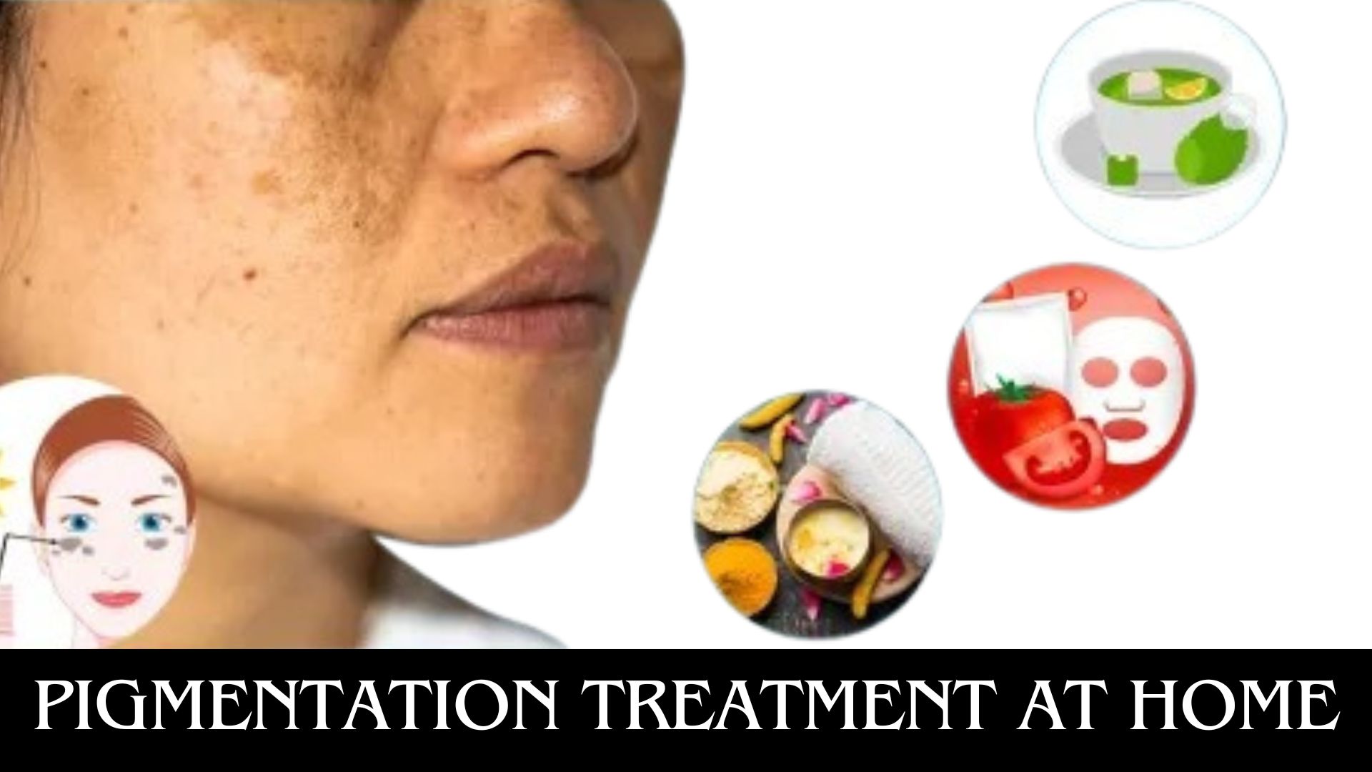 pigmentation treatment at home