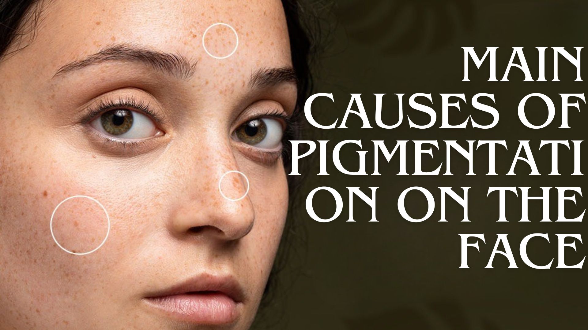 Main Causes of Pigmentation on the Face