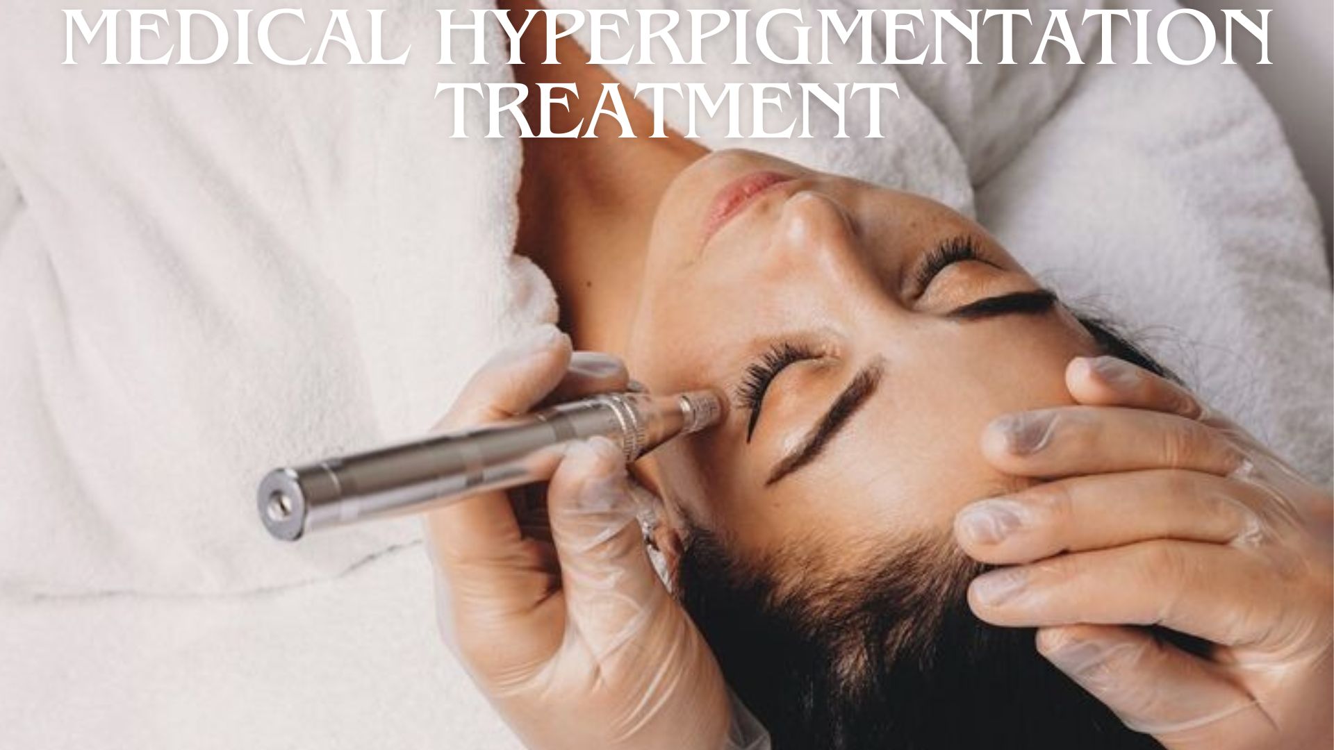 Medical Hyperpigmentation Treatment