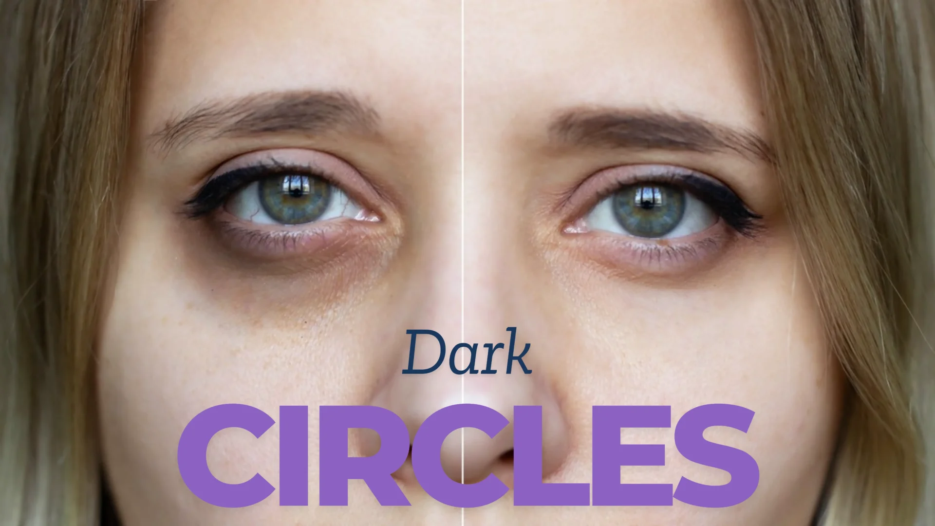 Dark Circles